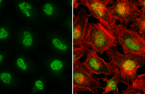 SP1 antibody detects SP1 protein at nucleus by immunofluorescent analysis. Sample: HeLa cells were fixed in 4% paraformaldehyde at RT for 15 min. Green: SP1 stained by SP1 antibody (GTX110593) diluted at 1:1000. Red: phalloidin, a cytoskeleton marker, diluted at 1:200.