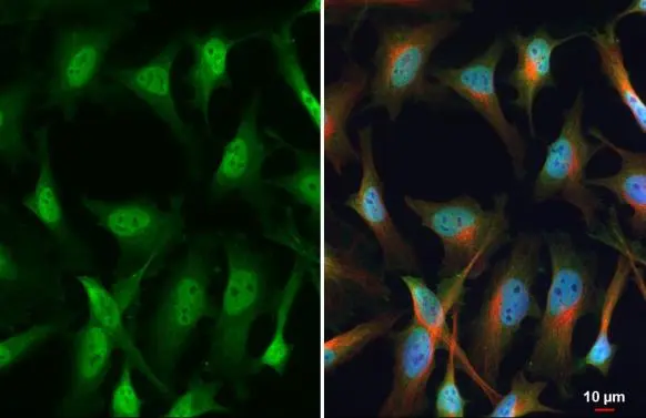 SP1 antibody detects SP1 protein at nucleus by immunofluorescent analysis. Sample: HeLa cells were fixed in 4% paraformaldehyde at RT for 15 min. Green: SP1 stained by SP1 antibody (GTX110593) diluted at 1:100. Red: alpha Tubulin, a cytoskeleton marker, stained by alpha Tubulin antibody [GT114] (GTX628802) diluted at 1:1000. Blue: Fluoroshield with DAPI (GTX30920).