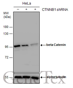 Non-transfected (–) and transfected (+) HeLa whole cell extracts (30 μg) were separated by 7.5% SDS-PAGE, and the membrane was blotted with beta Catenin antibody (GTX110594) diluted at 1:1000. Non-transfected (–) and transfected (+) HeLa whole cell extracts (30 μg) were separated by 7.5% SDS-PAGE, and the membrane was blotted with beta Catenin antibody (GTX110594) diluted at 1:1000.