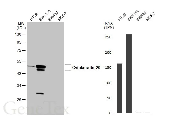 Various whole cell extracts (30 μg) were separated by 10% SDS-PAGE, and the membrane was blotted with Cytokeratin 20 antibody [N2C2], Internal (GTX110600) diluted at 1:1000. The HRP-conjugated anti-rabbit IgG antibody (GTX213110-01) was used to detect the primary antibody. Corresponding RNA expression data for the same cell lines are based on Human Protein Atlas program.