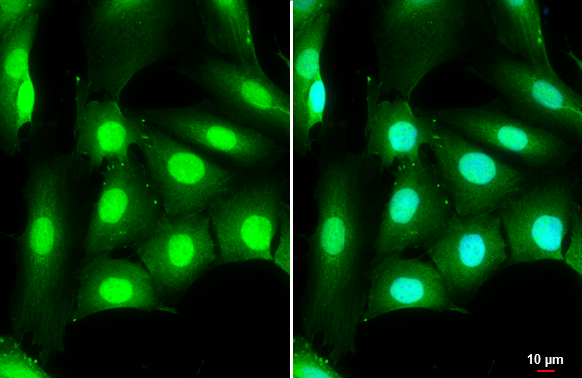 DDX3 antibody [N3C2], Internal detects DDX3 protein at cytoplasm and nucleus by immunofluorescent analysis. Sample: SK-N-SH cells were fixed in 4% paraformaldehyde at RT for 15 min. Green: DDX3 stained by DDX3 antibody [N3C2], Internal (GTX110614) diluted at 1:500. Blue: Hoechst 33342 staining. Scale bar= 10 μm.