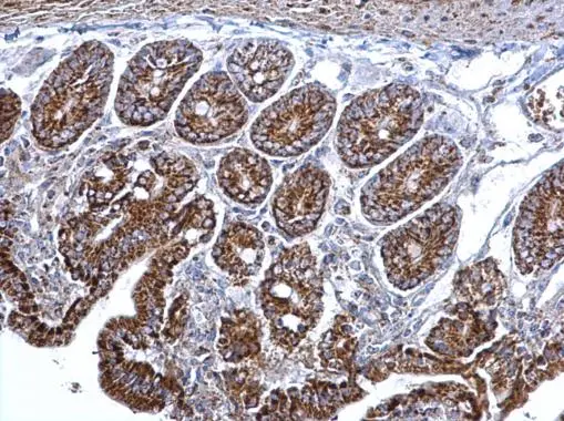 Anti-Citrate synthase antibody [N2C3] (GTX110624) | GeneTex