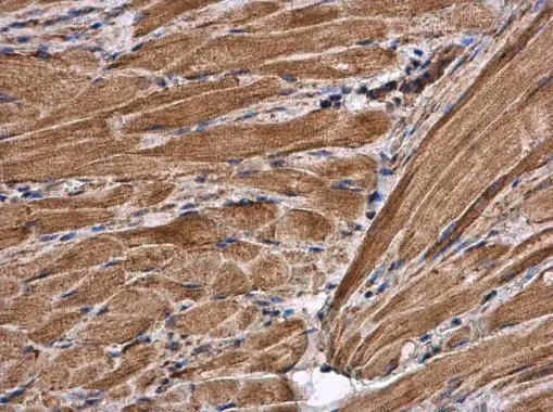Anti-Citrate synthase antibody [N2C3] (GTX110624) | GeneTex