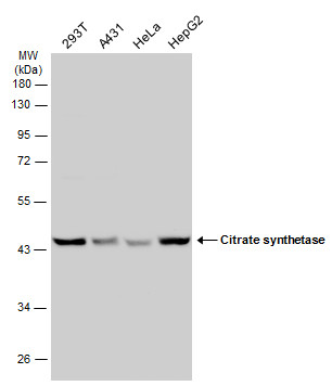 Various whole cell extracts (30 ug) were separated by 10% SDS-PAGE,and the membrane was blotted with Citrate synthetase antibody [N2C3] (GTX110624) diluted at 1:1000.