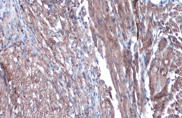 Various whole cell extracts (30 ug) were separated by 10% SDS-PAGE,and the membrane was blotted with Citrate synthetase antibody [N2C3] (GTX110624) diluted at 1:1000.