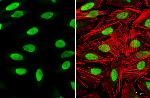 YY1 antibody detects YY1 protein at nucleus by immunofluorescent analysis. Sample: HeLa cells were fixed in 4% paraformaldehyde at RT for 15 min. Green: YY1 stained by YY1 antibody (GTX110625) diluted at 1:1000. Red: phalloidin, a cytoskeleton marker, diluted at 1:200. Scale bar= 10 μm.