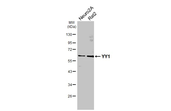 Various whole cell extracts (30 μg) were separated by 10% SDS-PAGE, and the membrane was blotted with YY1 antibody (GTX110625) diluted at 1:1000. The HRP-conjugated anti-rabbit IgG antibody (GTX213110-01) was used to detect the primary antibody.