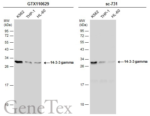 Various whole cell extracts (30 μg) were separated by 12% SDS-PAGE, and the membranes were blotted with 14-3-3 gamma antibody (GTX110629) diluted at 1:1000 and competitor's antibody (sc-731) diluted at 1:1000. The HRP-conjugated anti-rabbit IgG antibody (GTX213110-01) was used to detect the primary antibody.