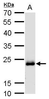 RAB6A antibody detects RAB6A protein by Western blot analysis. A. 50 μg mouse brain lysate/extract 12 % SDS-PAGE RAB6A antibody (GTX110646) dilution: 1:1000