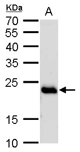 RAB6A antibody detects RAB6A protein by Western blot analysis. A. 50 μg rat brain lysate/extract 12 % SDS-PAGE RAB6A antibody (GTX110646) dilution: 1:1000