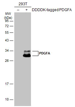 Non-transfected (–) and transfected (+) 293T whole cell extracts (30 μg) were separated by 12% SDS-PAGE, and the membrane was blotted with PDGFA antibody (GTX110647) diluted at 1:1000. The HRP-conjugated anti-rabbit IgG antibody (GTX213110-01) was used to detect the primary antibody.