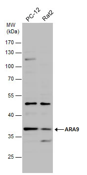 Various whole cell extracts (30 μg) were separated by 10% SDS-PAGE, and the membrane was blotted with ARA9 antibody [N1C3] (GTX110665) diluted at 1:500.