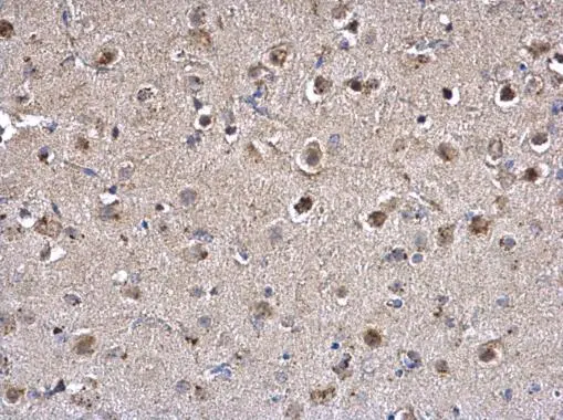 PPT1 antibody [N1C3] detects PPT1 protein at lysosome on mouse fore brain by immunohistochemical analysis. Sample: Paraffin-embedded mouse fore brain. PPT1 antibody [N1C3] (GTX110677) dilution: 1:500. Scale bar = M_2 μm. 
 Antigen Retrieval: Trilogy? (EDTA based, pH 8.0) buffer, 15min