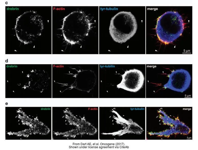 The data was published in the journal Oncogene in 2017. PMID: 28319065 The data was published in the journal Oncogene in 2017. PMID: 28319065