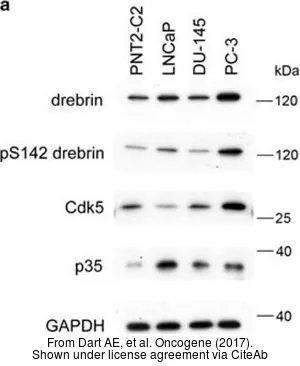 The data was published in the journal Oncogene in 2017. PMID: 28319065