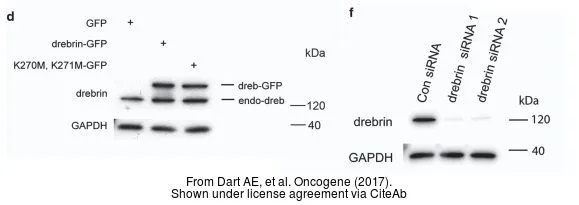 The data was published in the journal Oncogene in 2017. PMID: 28319065