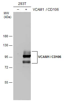Non-transfected (–) and transfected (+) 293T whole cell extracts (30 μg) were separated by 7.5% SDS-PAGE, and the membrane was blotted with VCAM1 / CD106 antibody [N1N2], N-term (GTX110684) diluted at 1:20000. The HRP-conjugated anti-rabbit IgG antibody (GTX213110-01) was used to detect the primary antibody.