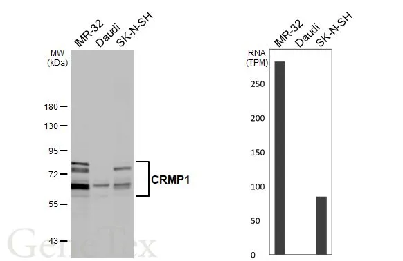 Various whole cell extracts (30 μg) were separated by 7.5% SDS-PAGE, and the membrane was blotted with CRMP1 antibody (GTX110688) diluted at 1:5000. The HRP-conjugated anti-rabbit IgG antibody (GTX213110-01) was used to detect the primary antibody. Corresponding RNA expression data are based on Human Protein Atlas program.