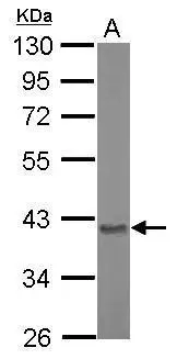 Sample (20 ug of whole cell lysate) A: Mouse brain 10% SDS PAGE GTX110699 diluted at 1:10000
