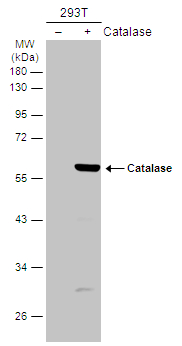 Non-transfected (–) and transfected (+) 293T whole cell extracts (30 μg) were separated by 10% SDS-PAGE, and the membrane was blotted with Catalase antibody (GTX110704) diluted at 1:1000. The HRP-conjugated anti-rabbit IgG antibody (GTX213110-01) was used to detect the primary antibody.