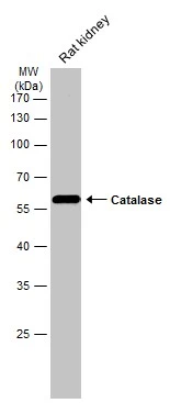 Rat tissue extract (50 μg) was separated by 10% SDS-PAGE, and the membrane was blotted with Catalase antibody (GTX110704) diluted at 1:1000. The HRP-conjugated anti-rabbit IgG antibody (GTX213110-01) was used to detect the primary antibody.