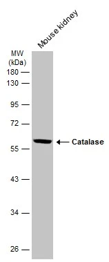 Mouse tissue extract (50 μg) was separated by 10% SDS-PAGE, and the membrane was blotted with Catalase antibody (GTX110704) diluted at 1:3000. The HRP-conjugated anti-rabbit IgG antibody (GTX213110-01) was used to detect the primary antibody.
