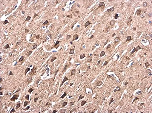 p38 MAPK antibody [N1C3-2] detects p38 MAPK protein at cytoplasm in rat brain by immunohistochemical analysis. Sample: Paraffin-embedded rat brain. p38 MAPK antibody [N1C3-2] (GTX110720) diluted at 1:500. 
 Antigen Retrieval: Citrate buffer, pH 6.0, 15 min