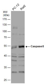 Various whole cell extracts (30 μg) were separated by 10% SDS-PAGE, and the membrane was blotted with Caspase 8 antibody (GTX110723) diluted at 1:1000. The HRP-conjugated anti-rabbit IgG antibody (GTX213110-01) was used to detect the primary antibody.