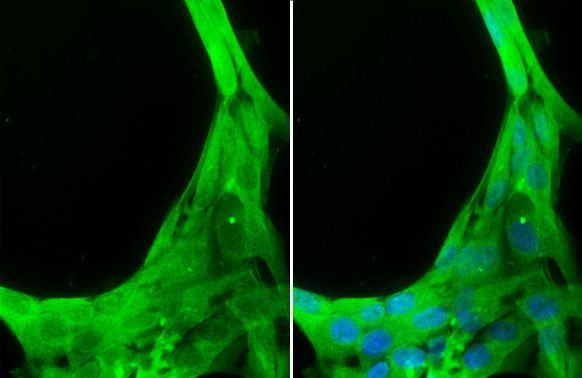 Caspase 8 antibody detects Caspase 8 protein at cytoplasm by immunofluorescent analysis. Sample: PG-4 cells were fixed in 4% paraformaldehyde at RT for 15 min. Green: Caspase 8 stained by Caspase 8 antibody (GTX110723) diluted at 1:100. Blue: Hoechst 33342 staining.