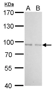 FOXO1 antibody detects FOXO1 protein by western blot analysis. A. 30 ug 293T whole cell lysate/extract B. 30 ug A431 whole cell lysate/extract 7.5 % SDS-PAGE FOXO1 antibody (GTX110724) dilution: 1:500