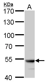 ATP6V1B2 antibody detects ATP6V1B2 protein by western blot analysis. A. 50 μg rat brain lysate/extract 7.5 % SDS-PAGE ATP6V1B2 antibody (GTX110783) dilution: 1:5000 ATP6V1B2 antibody detects ATP6V1B2 protein by western blot analysis. A. 50 μg rat brain lysate/extract 7.5 % SDS-PAGE ATP6V1B2 antibody (GTX110783) dilution: 1:5000