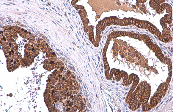 ALDH1A3 antibody [N2C2], Internal detects ALDH1A3 protein at cytoplasm by immunohistochemical analysis. Sample: Paraffin-embedded mouse prostate. ALDH1A3 stained by ALDH1A3 antibody [N2C2], Internal (GTX110784) diluted at 1:500. Antigen Retrieval: Citrate buffer, pH 6.0, 15 min