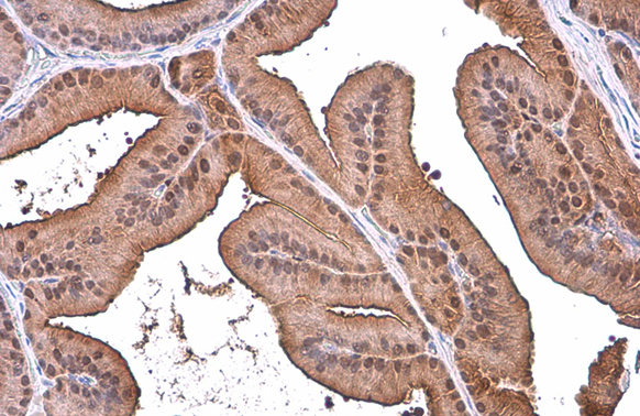 ALDH1A3 antibody [N2C2], Internal detects ALDH1A3 protein at cytoplasm by immunohistochemical analysis. Sample: Paraffin-embedded rat prostate. ALDH1A3 stained by ALDH1A3 antibody [N2C2], Internal (GTX110784) diluted at 1:500. Antigen Retrieval: Citrate buffer, pH 6.0, 15 min
