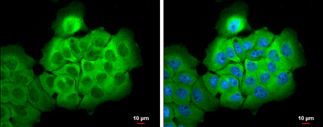 ALDH1A3 antibody [N2C2], Internal detects ALDH1A3 protein at cytoplasm by immunofluorescent analysis. Sample: A431 cells were fixed in 4% paraformaldehyde at RT for 15 min. Green: ALDH1A3 stained by ALDH1A3 antibody [N2C2], Internal (GTX110784) diluted at 1:500. Blue: Hoechst 33342 staining. Scale bar= 10μm.