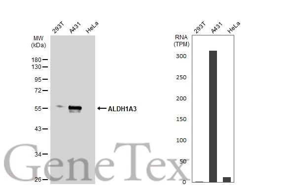 Various whole cell extracts (30 μg) were separated by 10% SDS-PAGE, and the membrane was blotted with ALDH1A3 antibody [N2C2], Internal (GTX110784) diluted at 1:500. The HRP-conjugated anti-rabbit IgG antibody (GTX213110-01) was used to detect the primary antibody. Corresponding RNA expression data for the same cell lines are based on Human Protein Atlas program.