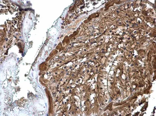 ATP6V1A antibody detects ATP6V1A protein at cytoplasm on mouse prostate by immunohistochemical analysis. Sample: Paraffin-embedded mouse prostate. ATP6V1A antibody (GTX110815) diluted at 1:500. 
 Antigen Retrieval: Trilogy? (EDTA based, pH 8.0) buffer, 15min