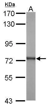 Sample (20 μg of whole cell lysate) A: mouse brain 7.5% SDS PAGE GTX110815 diluted at 1:5000 The HRP-conjugated anti-rabbit IgG antibody (GTX213110-01) was used to detect the primary antibody.