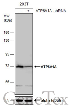 Non-transfected (–) and transfected (+) 293T whole cell extracts (30 μg) were separated by 7.5% SDS-PAGE, and the membrane was blotted with ATP6V1A antibody (GTX110815) diluted at 1:5000. The HRP-conjugated anti-rabbit IgG antibody (GTX213110-01) was used to detect the primary antibody.