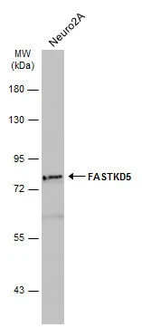 Whole cell extract (30 μg) was separated by 7.5% SDS-PAGE, and the membrane was blotted with FASTKD5 antibody [C2C3], C-term (GTX110844) diluted at 1:1000. The HRP-conjugated anti-rabbit IgG antibody (GTX213110-01) was used to detect the primary antibody, and the signal was developed with Trident ECL plus-Enhanced.