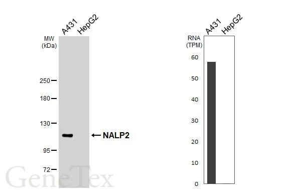 Various whole cell extracts (30 μg) were separated by 5% SDS-PAGE, and the membrane was blotted with NALP2 antibody [N3C2], Internal (GTX110886) diluted at 1:10000. The HRP-conjugated anti-rabbit IgG antibody (GTX213110-01) was used to detect the primary antibody. Corresponding RNA expression data for the same cell lines are based on Human Protein Atlas program.