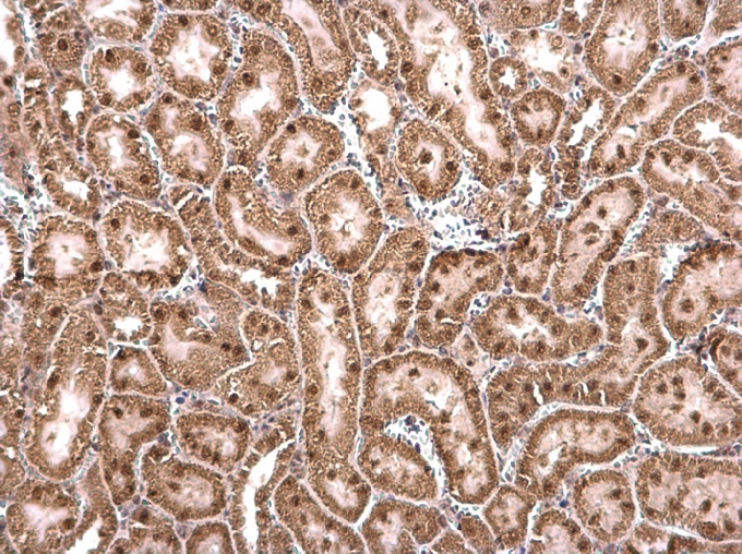 CCAR1 antibody detects CCAR1 protein at nucleus on mouse kidney by immunohistochemical analysis. Sample: Paraffin-embedded mouse kidney. CCAR1 antibody (GTX110892) dilution: 1:500. 
 Antigen Retrieval: Trilogy? (EDTA based, pH 8.0) buffer, 15min