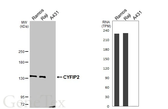 Various whole cell extracts (30 μg) were separated by 5% SDS-PAGE, and the membrane was blotted with CYFIP2 antibody [N2C1], Internal (GTX110897) diluted at 1:1000. The HRP-conjugated anti-rabbit IgG antibody (GTX213110-01) was used to detect the primary antibody. Corresponding RNA expression data are based on Human Protein Atlas program.