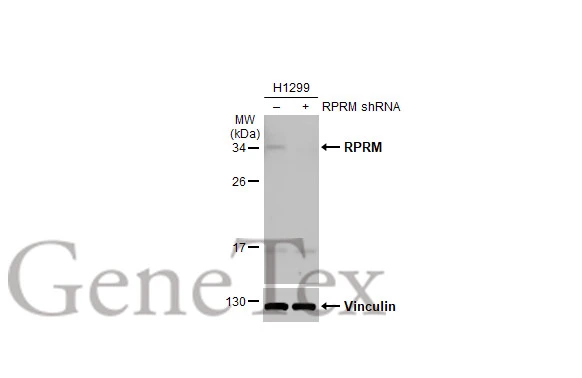 RPRM antibody [N1C3]