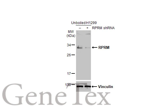 RPRM antibody [N1C3]