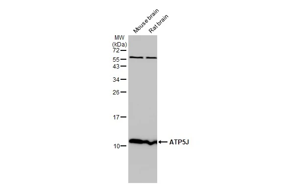 Various tissue extracts (50 μg) were separated by 15% SDS-PAGE, and the membrane was blotted with ATP5J antibody (GTX110996) diluted at 1:1000. The HRP-conjugated anti-rabbit IgG antibody (GTX213110-01) was used to detect the primary antibody.