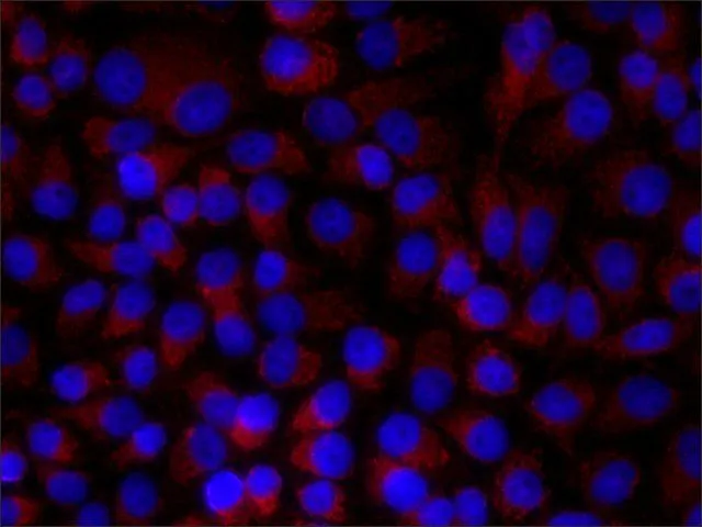 WB analysis of (1) HEK-293T (2) HeLa (3) A431 (4) JURKAT (5) NIH-3T3 cell lysate using GTX11101 Paxillin antibody [PXC-10] at 1:500.