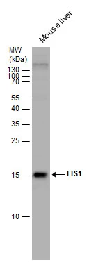 FIS1 antibody detects FIS1 protein by western blot analysis. Mouse tissue extracts (50 μg) was separated by 15% SDS-PAGE, and the membrane was blotted with FIS1 antibody (GTX111010) diluted by 1:5000. The HRP-conjugated anti-rabbit IgG antibody (GTX213110-01) was used to detect the primary antibody. FIS1 antibody detects FIS1 protein by western blot analysis. Mouse tissue extracts (50 μg) was separated by 15% SDS-PAGE, and the membrane was blotted with FIS1 antibody (GTX111010) diluted by 1:5000. The HRP-conjugated anti-rabbit IgG antibody (GTX213110-01) was used to detect the primary antibody.