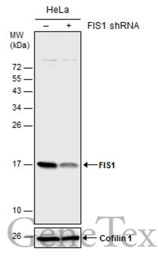 Non-transfected (–) and transfected (+) HeLa whole cell extracts (30 μg) were separated by 15% SDS-PAGE, and the membrane was blotted with FIS1 antibody (GTX111010) diluted at 1:5000. The HRP-conjugated anti-rabbit IgG antibody (GTX213110-01) was used to detect the primary antibody. Non-transfected (–) and transfected (+) HeLa whole cell extracts (30 μg) were separated by 15% SDS-PAGE, and the membrane was blotted with FIS1 antibody (GTX111010) diluted at 1:5000. The HRP-conjugated anti-rabbit IgG antibody (GTX213110-01) was used to detect the primary antibody.