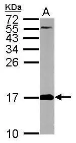 Sample (50 μg of whole cell lysate) A: mouse brain 15% SDS PAGE GTX111010 diluted at 1:5000 The HRP-conjugated anti-rabbit IgG antibody (GTX213110-01) was used to detect the primary antibody. Sample (50 μg of whole cell lysate) A: mouse brain 15% SDS PAGE GTX111010 diluted at 1:5000 The HRP-conjugated anti-rabbit IgG antibody (GTX213110-01) was used to detect the primary antibody.