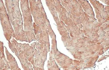 FIS1 antibody detects FIS1 protein at cytoplasm by immunohistochemical analysis. Sample: Paraffin-embedded mouse heart. FIS1 stained by FIS1 antibody (GTX111010) diluted at 1:500. Antigen Retrieval: Citrate buffer, pH 6.0, 15 min FIS1 antibody detects FIS1 protein at cytoplasm by immunohistochemical analysis. Sample: Paraffin-embedded mouse heart. FIS1 stained by FIS1 antibody (GTX111010) diluted at 1:500. Antigen Retrieval: Citrate buffer, pH 6.0, 15 min